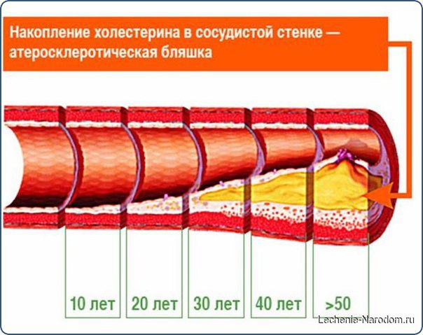 Проверенные поколениями народные средства.