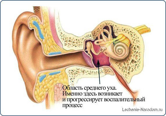 Ну очень неприятное заболевание и как его просто вылечить.