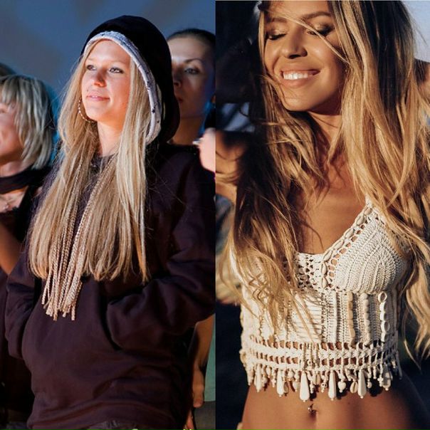 «Пластика мозга и души»: Рита Дакота откровенно рассказала об операциях
