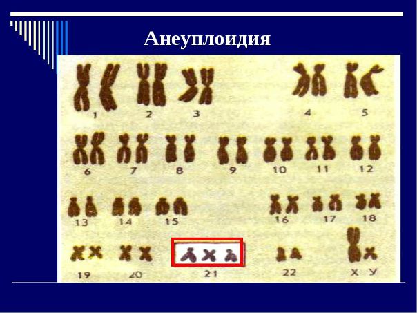 Хромосомное отклонение поможет разобраться с процессом старения