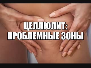 Где образуется целлюлит у девушек Локализация целлюлита на теле у девушек Целлюлит на шее, икрах, проблемные женские зоны Массаж