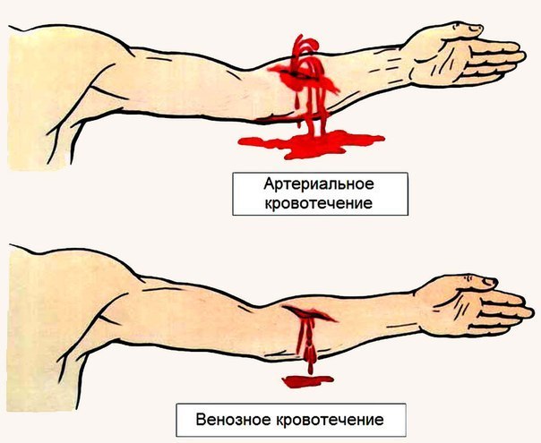 Кровотечения 