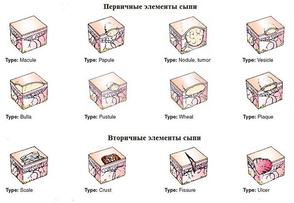Элементы сыпи 