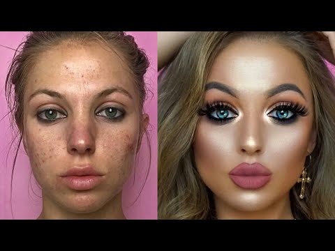 Ameliyat Olsa Bu Kadar Değişmezdi HD
