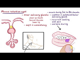 Mucocele - Types, Clinical Features, Histopathology Treatment. Стоматология.