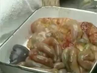 Вскрытие Молодой Японки