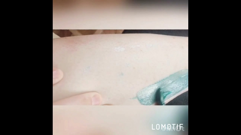 Депиляция