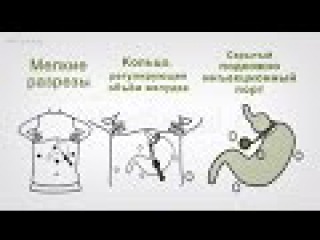 Показания к терапии и лечение ожирения