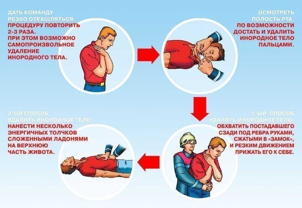 Прием Геймлиха. Это надо знать каждому. 