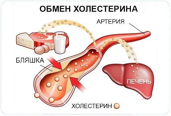 Уровень холестерина можно снизить без проблем! 
