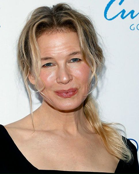48-летней Рене Зеллвегер сделали неудачные инъекции ботокса!