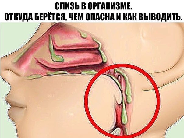 СЛИЗЬ В ОРГАНИЗМЕ. 