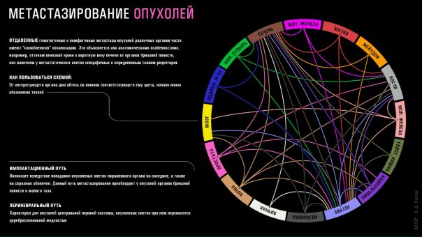 Метастазирование - образование вторичных очагов опухолевого роста (метастазов) в результате распространения клеток из первичного очага в другие ткани. Метастазы возникают только из злокачественных новообразований. 