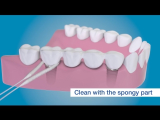 Суперфлосс, как чистить вокруг имплантатов с помощью TePe Bridge Implant Floss