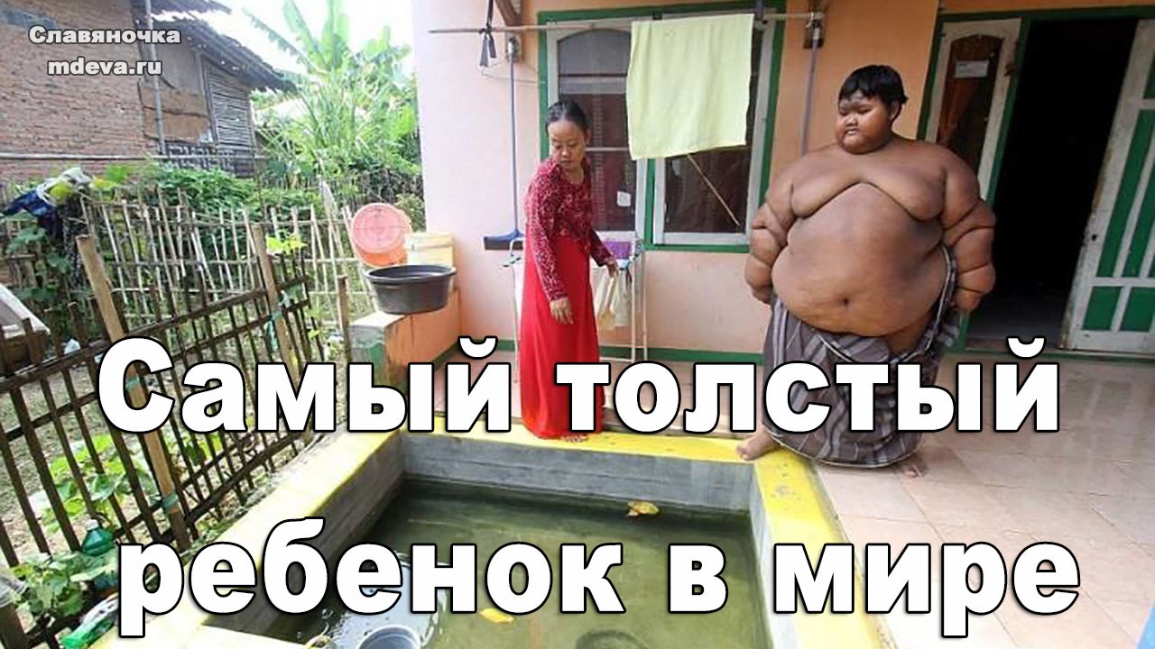 Арья Пермана — самый толстый ребенок в мире Арья Пермана — самый толстый ребенок в мире