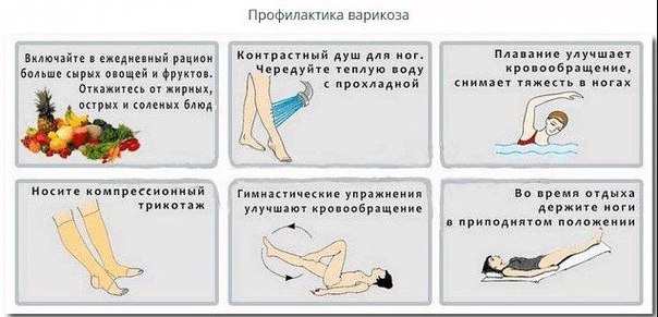 Профилактика варикоза нужна, прежде всего, тем, кто находится в группе риска. В эту категорию входит большое количество людей, и среди них: 
