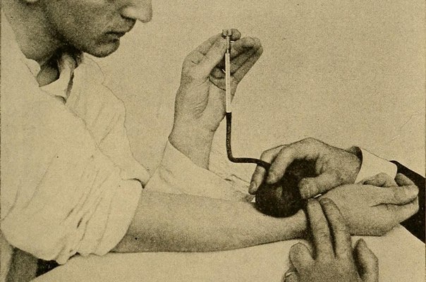 Насколько точно тонометры измеряют давление Хотя от них зависит жизнь пациентов, до сих пор в этих датчиках не сомневались. Новый эксперимент показал, что тонометры «врут» в двух из трех случаев.
