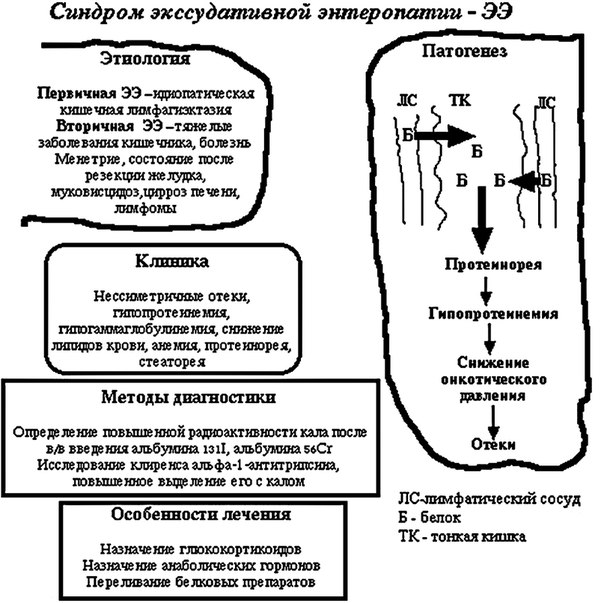 Синдром экссудативной энтеропатии 