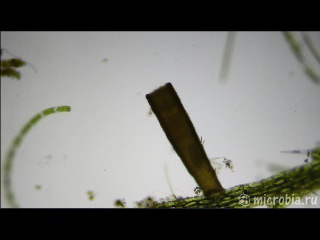 Floscularia ringens (rotifer) / Коловратка флоскулария