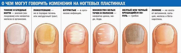 Лечение грибка ногтей