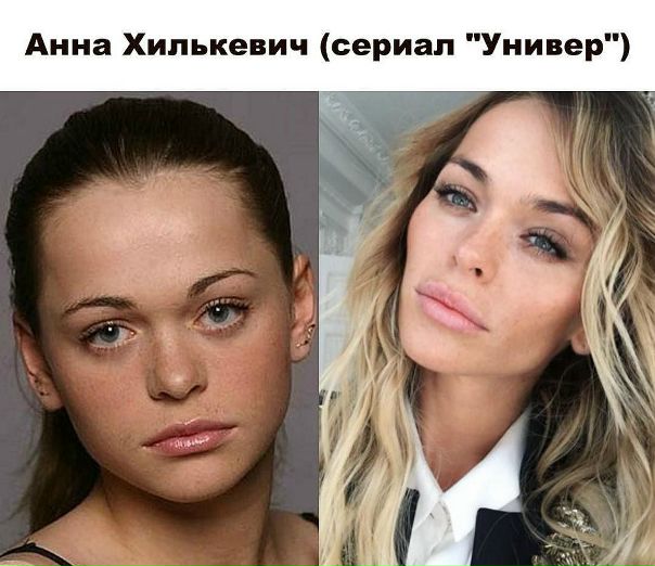 А это Анна Хилькевич с макияжем и без!