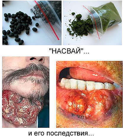 Лига наркотик Лига наркотик марихуана сохраняется в крови