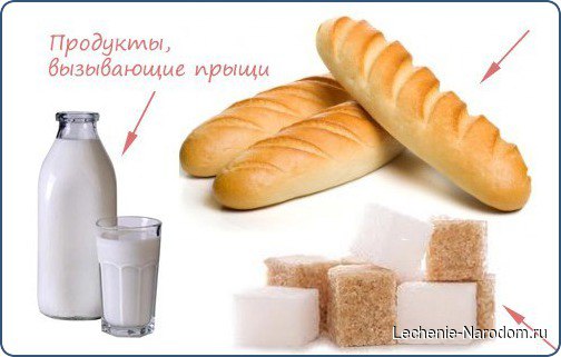 Какие продукты вызывают прыщи