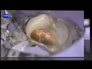 MICRO DENTISTRY - ARIEL SAVION