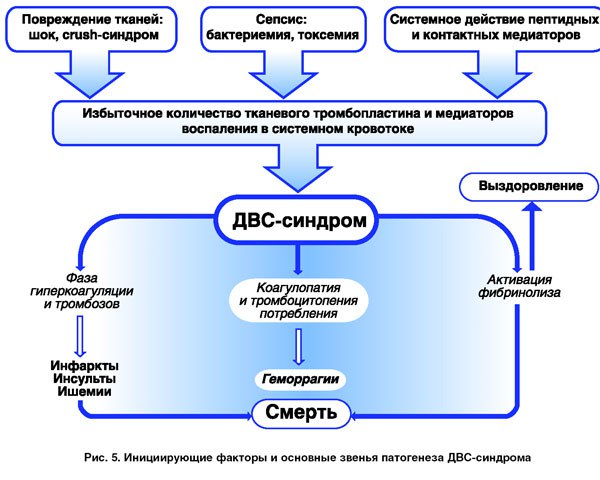 Двс-синдром в акушерстве 