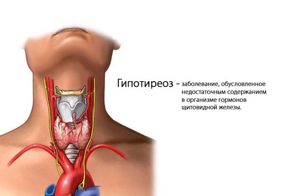 Дефицит гормонов щитовидной железы повышает риск выкидыша и других проблем