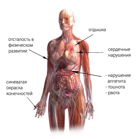 Основные синдромы нейроцируляторной дистонии: 