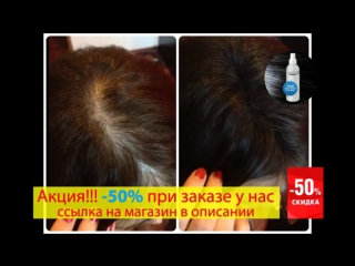 Спрей для волос Ultra Hair System