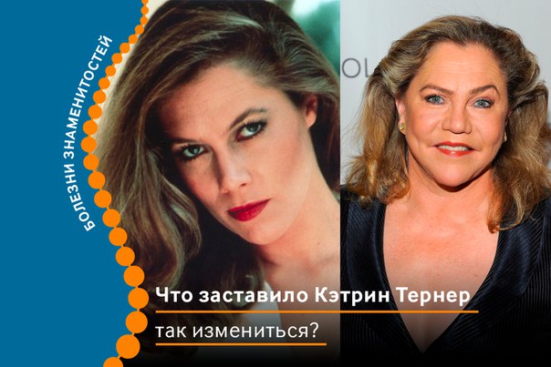 Актрисе Кэтрин Тернер было 39 лет, она находилась на пике своей карьеры и снималась в очередном голливудском фильме. На съемочной площадке по команде «Мотор!» она по привычке резво вскочила с места – и чуть не вскрикнула от боли, которая обожгла ее колени. Ничего подобного она никогда не испытывала.