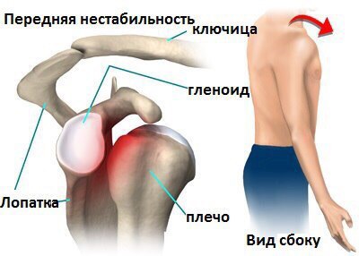 Гегрома левого плечевого сустава опухали на суставах у игуаны