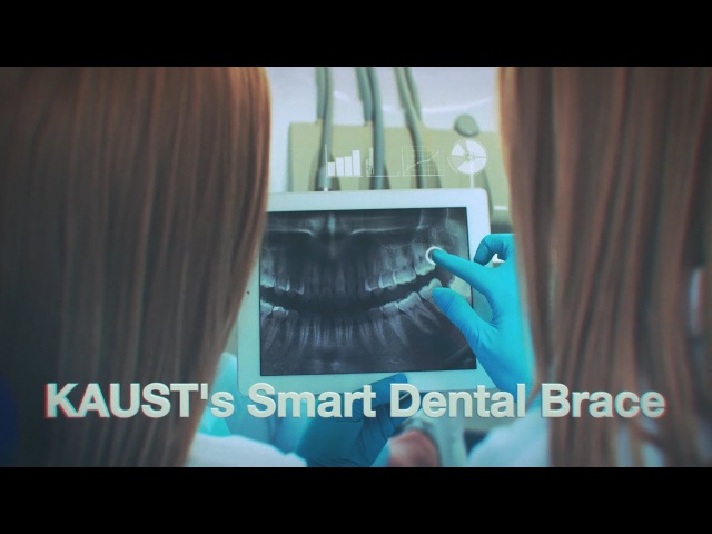 KAUST Dental Brace Technology
