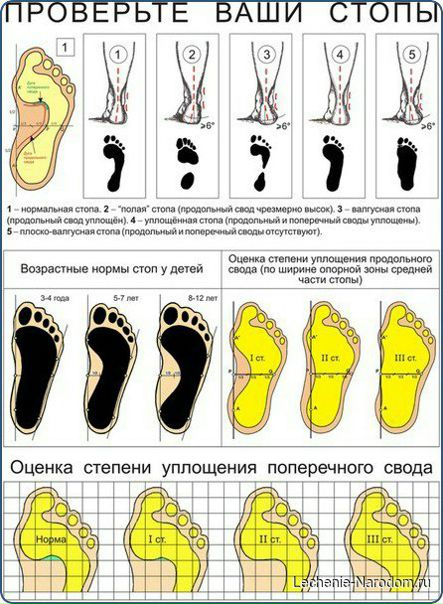Пожалуйста, берегите ноги !