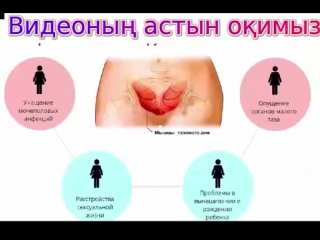Әйелдерге жыныстық мүшені тарылтатын гель