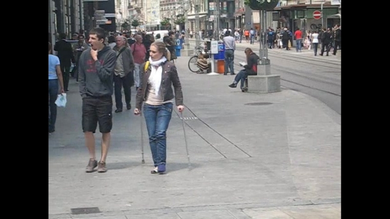 08-06-15_Girl_blue_sock_crutches (2)