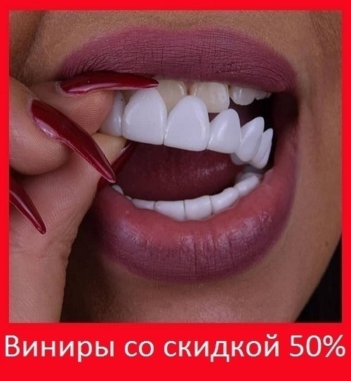 Крacивaя улыбкa зa 2 минуты!