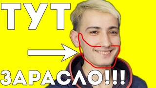 Миноксидил для бороды 1,5 месяца! РЕЗУЛЬТАТЫ У ИСЫ ДО И ПОСЛЕ! ЧЕТКИЙ!