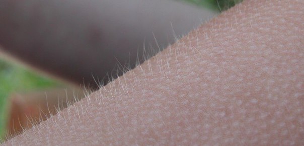 ПОЧЕМУ ПОЯВЛЯЮТСЯ МУРАШКИ 