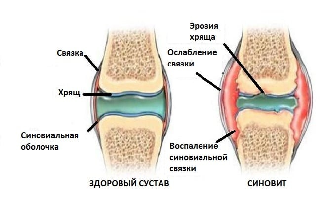 Синовит Синовит