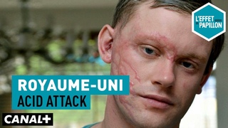 Royaume-Uni : Acid attack - L'Effet Papillon — CANAL+