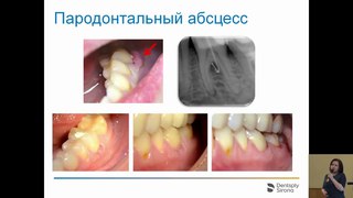 Татьяна Иванова