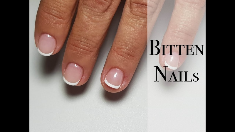 Bitten nails Problem cuticle