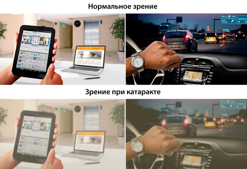 Набор линз для подбора очков цена - saroclogtopsho’s blog