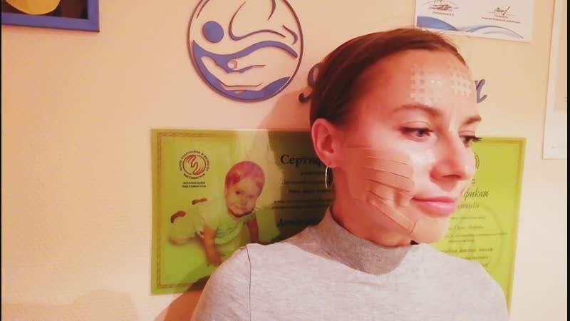 Тейпирование лица
