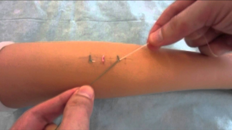 Hitch knitting techniques