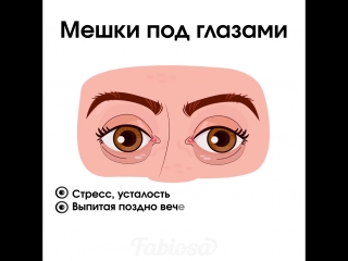 Что говорят ваши глаза о здоровье