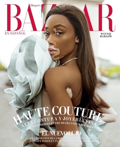 Winnie Harlow появилась на обложке журнала! 